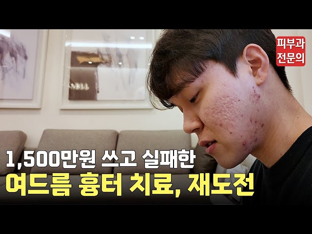여드름 흉터, 절망에서 희망으로 바뀐 리얼 후기ㅣ동대문 피부과, 청량리 피부과, 흉터전문 피부과, 흉터 치료, 여드름 흉터, 여드름 흉터 레이저