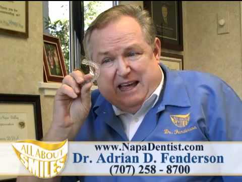 Invisalign by Dr Adrian D Fenderson Dentist Napa CA