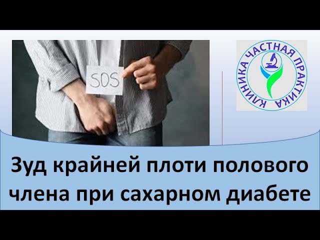 Зуд крайней плоти полового члена при сахарном диабете