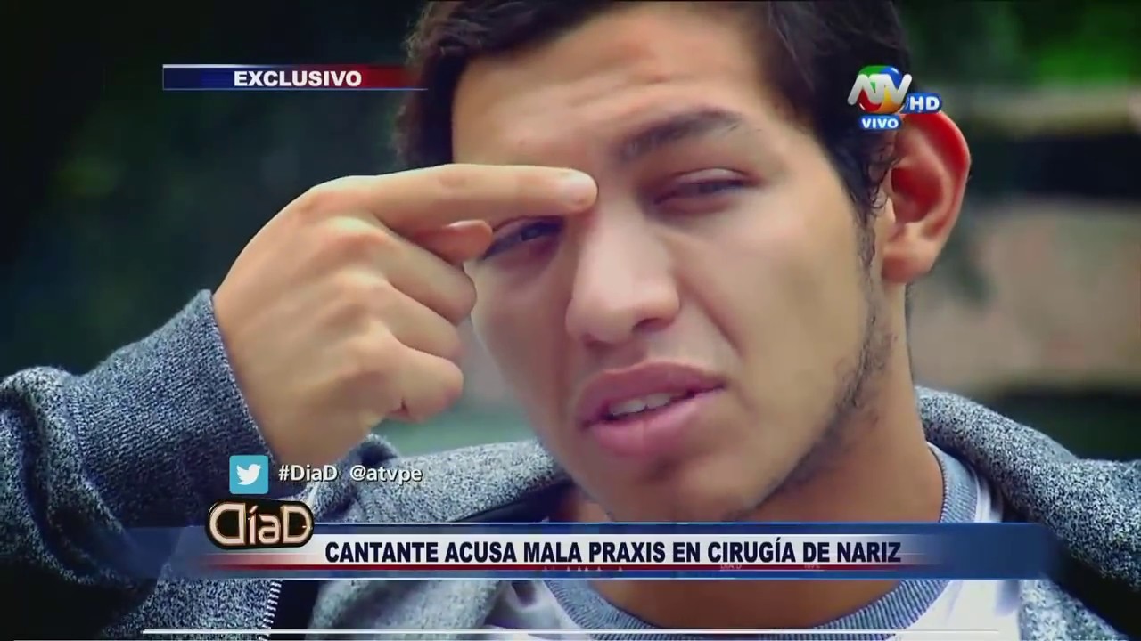 Cantante acusa mala praxis en la cirugía de su nariz