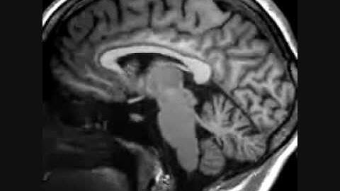 HEADSCAN - LOLIFE