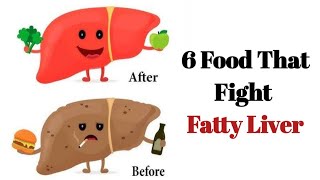 Fatty Liver Treatment | Fatty Liver Diet | Liver Detox | Fatty Liver | Fatty Liver Symptoms