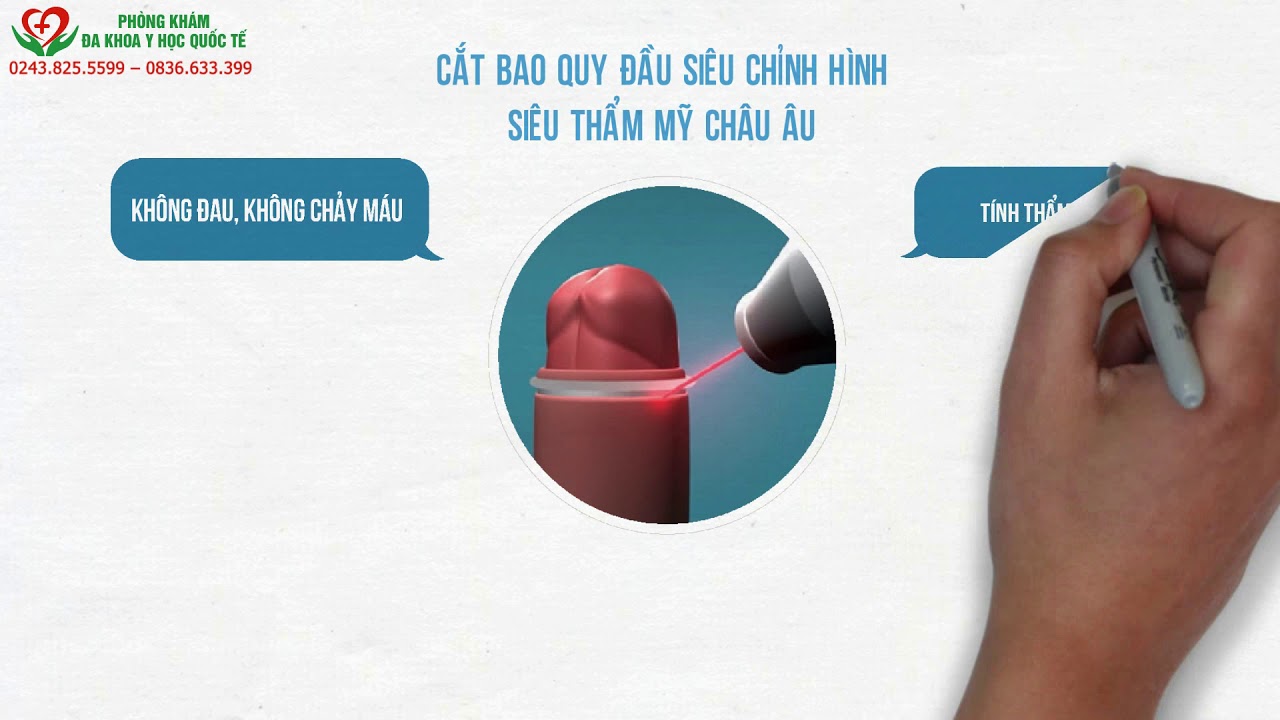 Video cắt bao quy đầu bằng phương pháp siêu chỉnh hình... - youtube