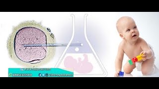 عملية طفل الانابيب في تركيا |زراعة طفل الانبوب |افضل مستشفيات الحقن المجهري  في اسطنبول