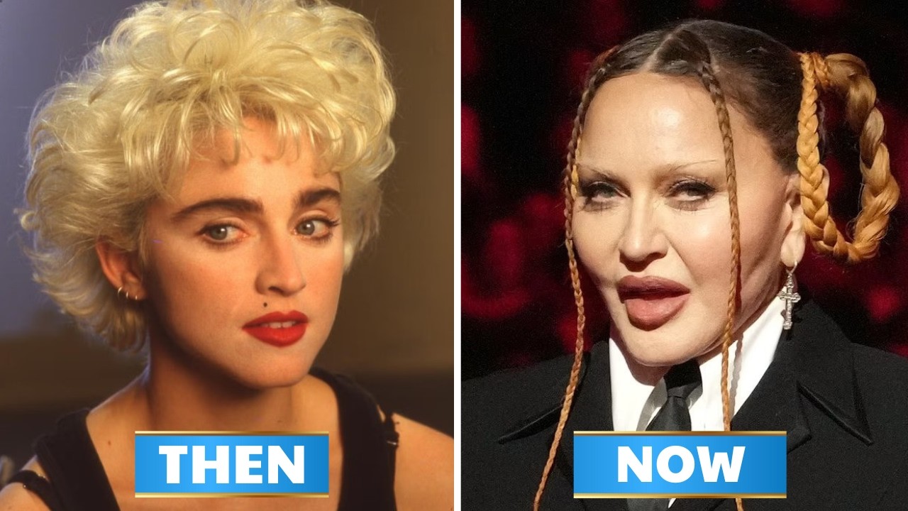 10 пластических операций знаменитостей, которые шокировали интернет | Тогда и сейчас (2026)