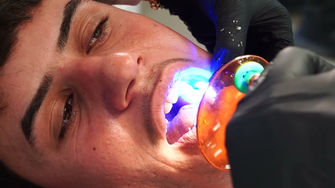 فيديو كلية طب الاسنان