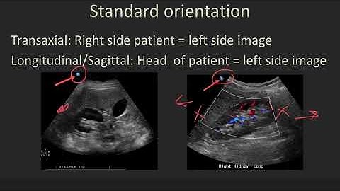 Ultrasound 101 Part 4 Technique.mp4