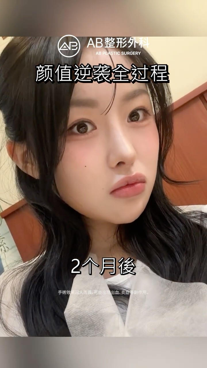 輪廓三件套 眼整形 鼻整形打造女神感✨ #Shorts