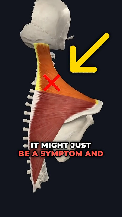 Tight Upper Traps causing Shoulder Pain?