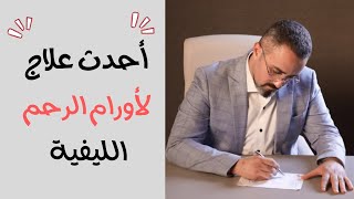 علاج أورام الرحم الليفية