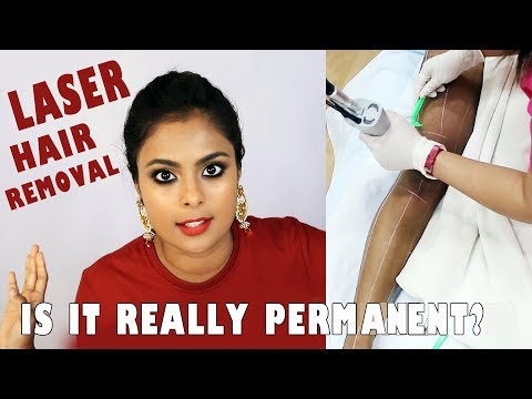 THINGS NOONE TELLS YOU ABOUT LASER HAIR REMOVAL - ON BROWN SKIN