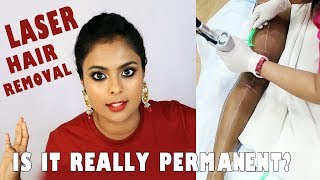THINGS NOONE TELLS YOU ABOUT LASER HAIR REMOVAL - ON BROWN SKIN