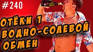 отёки.водно солевой обмен отёки.водно солевой обмен