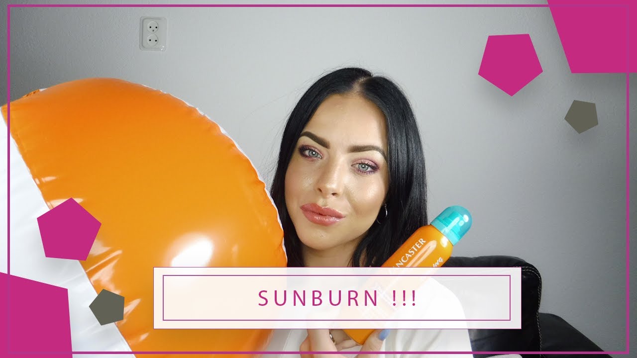 ZO ROOD ALS EEN TOMAAT | SUNBURN | AFTER SUN | LANCASTER - BE ELISE #17