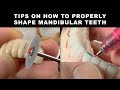 Tips on how to Properly Shape Mandibular Teeth