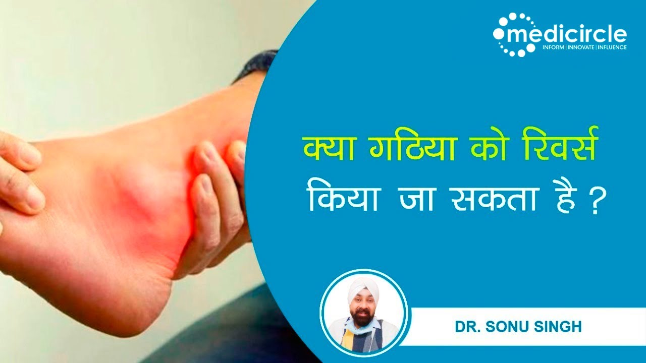 Arthritis (आर्थराइटिस) kya hai? Does arthritis pain spread? Cause of