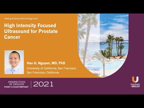 Video High Intensity Focused Ultrasound for Prostate Cancer - youtube