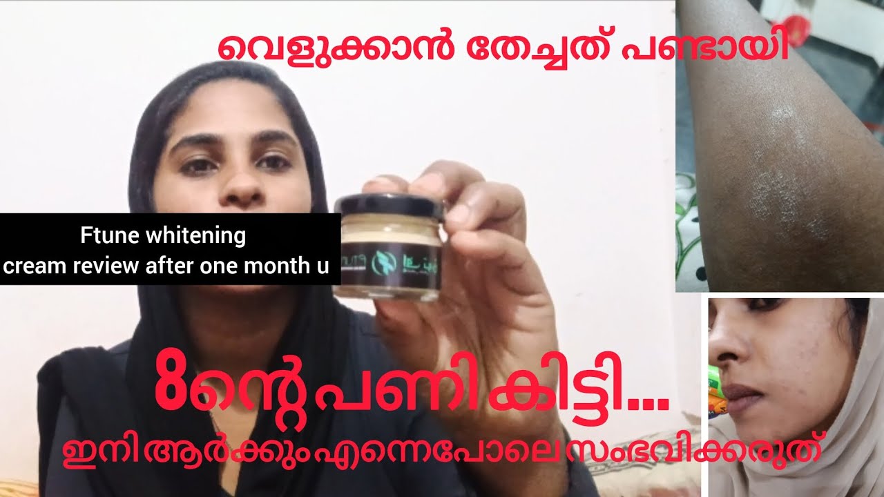 Ftune cream പണി പാളി Ftune whitening cream side efects|Ftune cream review after one month use