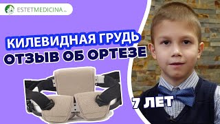 Внешние ОРТЕЗЫ для килевидной деформации грудной клетки. 🙌Отзыв мамы пациента 7 лет💡