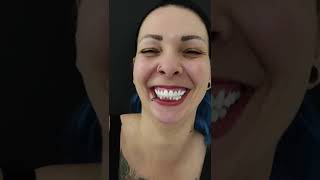 Fast And Aesthetic Smile Makeover In Turkey Maltepe Dental Clinic, Istanbul