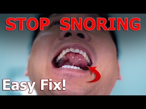 Video: Hoe om te stop met snork deur 'n mondsnorkende mondstuk te gebruik