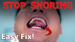 Stop Snoring IMMEDIATELY With This Body Hack | Physical Therapist screenshot 2