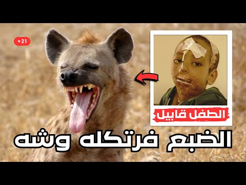 الضبع قطعله ودانه وأكله لسانه ومسحله وشه الدقائق المرعبه للطفل الاثيوبي قابيل