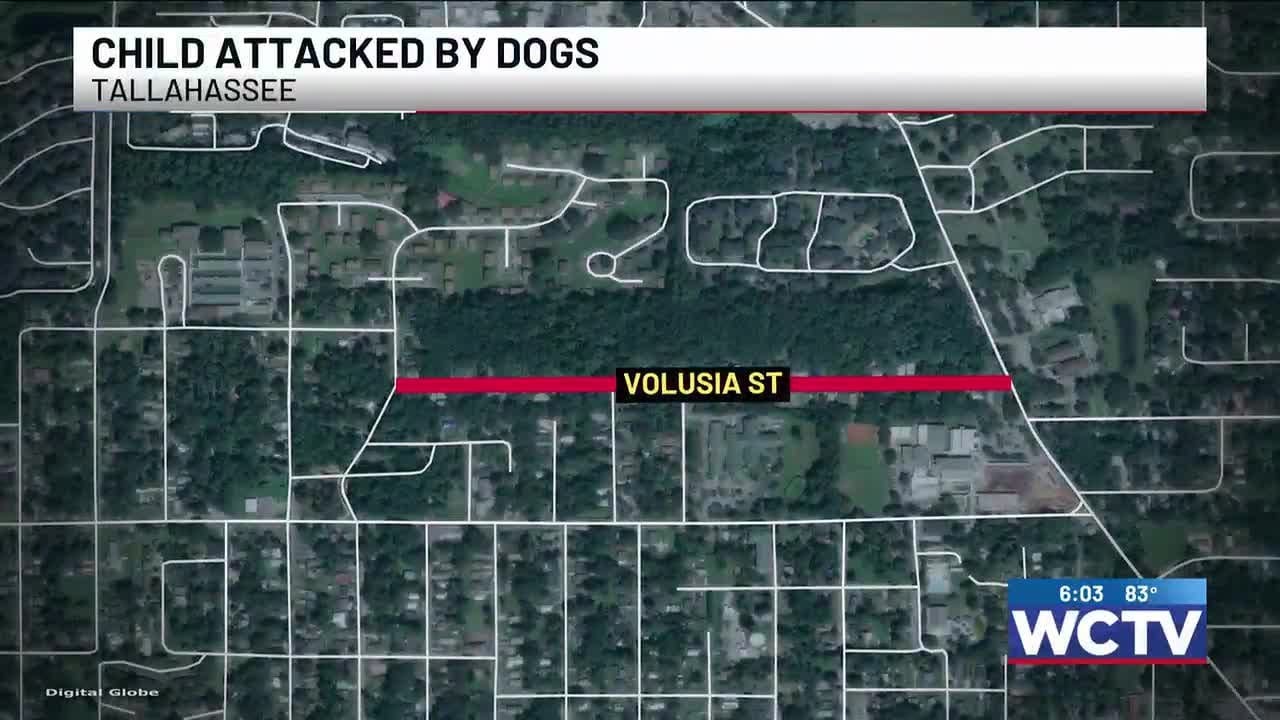 Child attacked by dogs in Tallahassee - YouTube