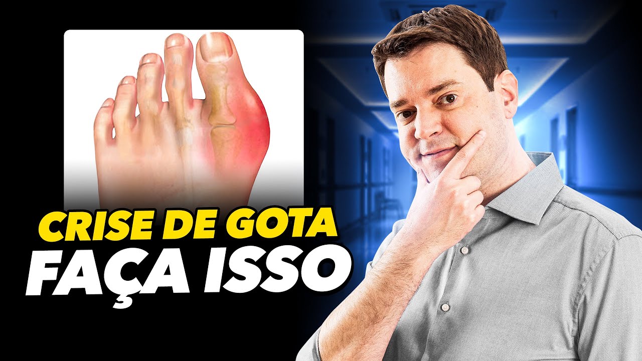 Crise De Gota, Faça Isso ao Tratar Pacientes Com Crise De Gota YouTube