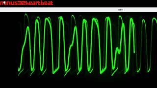 minus32heartbeat_29823