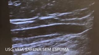 Catarina Almeida-34