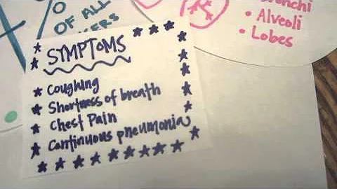 Stem Cells and Lung Cancer - Group #54 AM