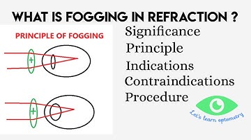 Fogging in subjective refraction| significance | Procedure