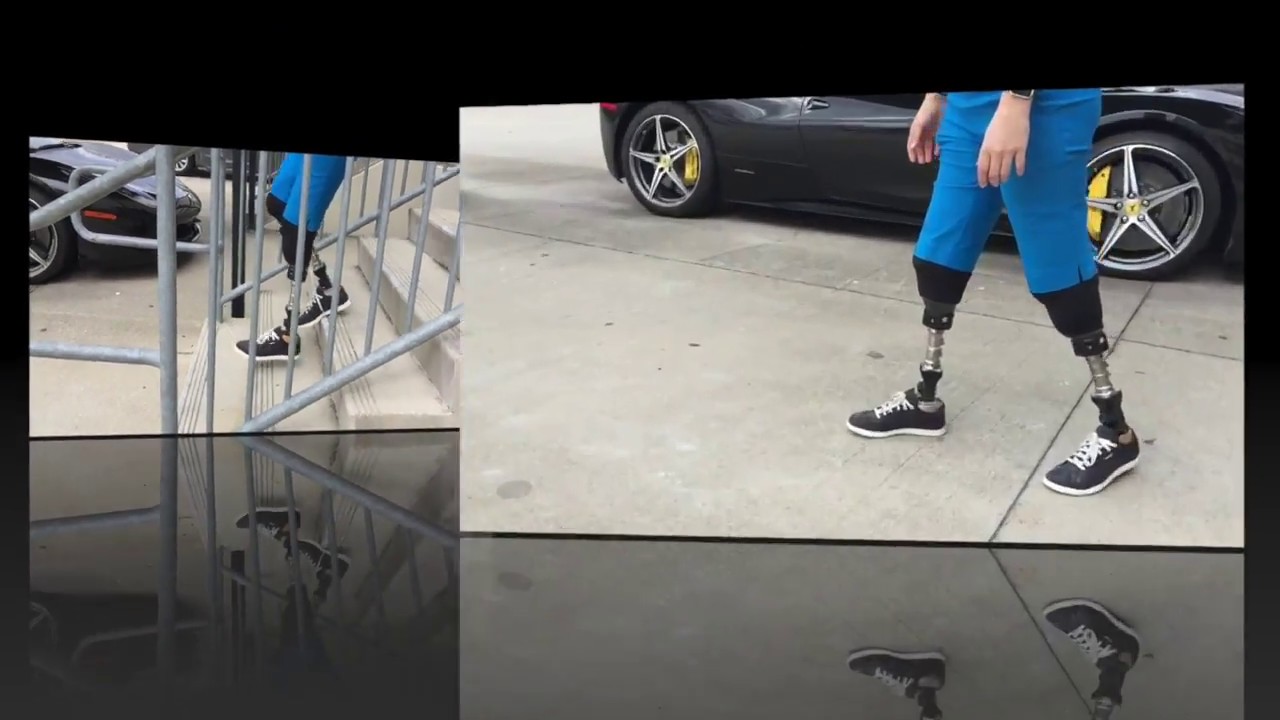 Bilateral Transtibial Amputee on TaiLor Made Foot YouTube