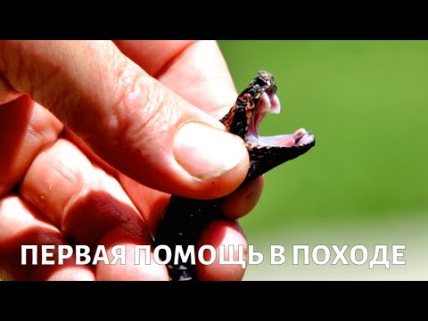 Укус змеи, растяжение связок, ожог борщевиком: правила безопасности в походе