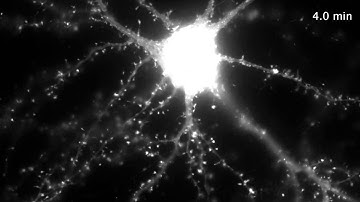 GFP-actin in dendritic spines