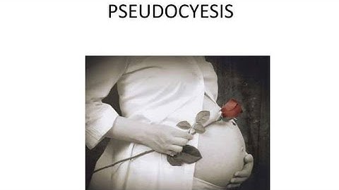 Pseudocyesis; false pregnancy or phantom pregnancy,psychological condition, person believes they are