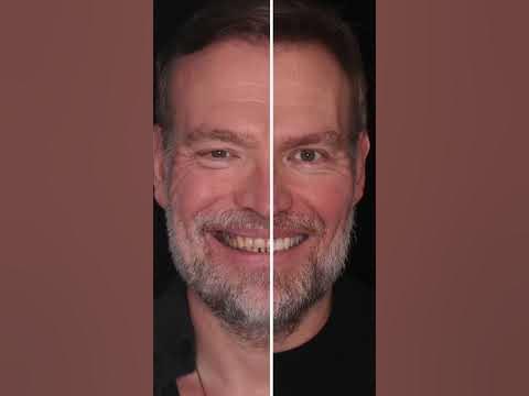 Мужская улыбка с идеальными зубами - YouTube