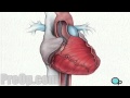 Balloon angioplasty coronary angioplasty  preop patient education medical