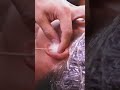 Enjoy the ultimate relaxation with a video of ear cleaning.