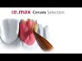 Ips emax ceram selection