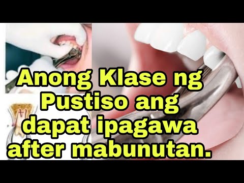 Video: Gaano katagal dapat maghintay bago magpakasal?