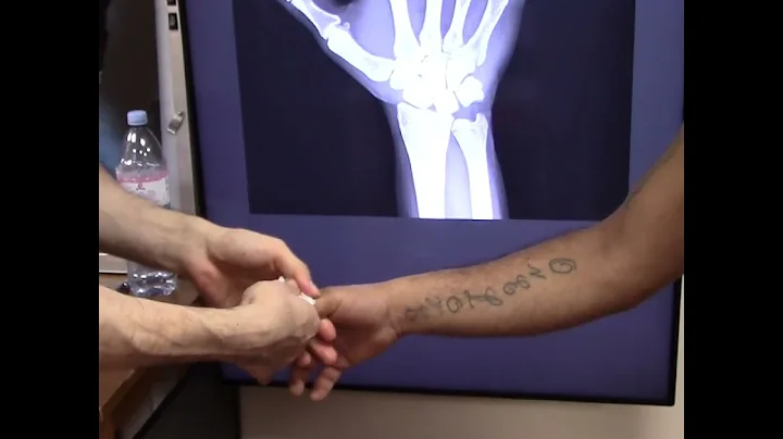 Insane CRACK for Thumb pain