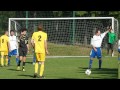 CETKOVICE SKALICE N.SV. B 1 1