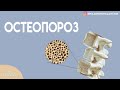 Остеопороз