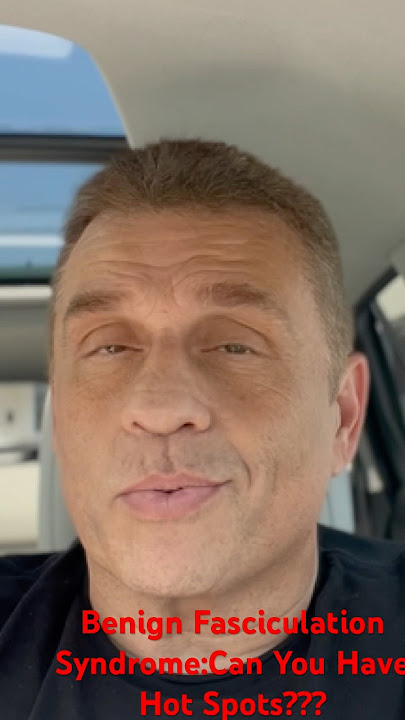 #anxiety#bfs#muscletwitching Benign Fasciculation Syndrome:Can You Have Hot Spots???