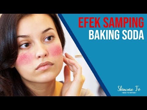 Video: Baking Soda For The Face: Mencuci Wajah Dan Efek Samping