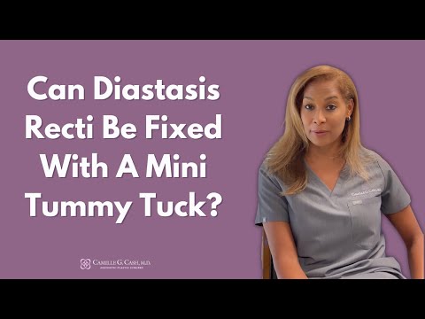 Video: Apakah asuransi akan membayar untuk perbaikan diastasis recti?