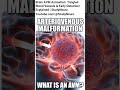 Brain Arteriovenous Malformation Animation Tangled Blood Vessels & Early Detection Explained