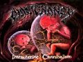 Malignancy - Bag